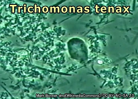 トリコモナス・テナックス（Trichomonas tenax）の顕微鏡写真