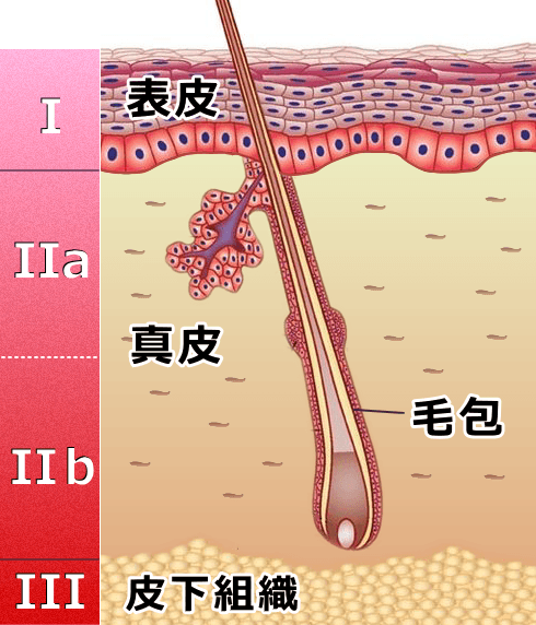 した 対処 法 時 の 火傷