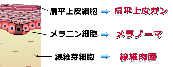 犬のガンの種類～扁平上皮ガン・メラノーマ・線維肉腫