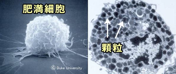 肥満細胞の顕微鏡写真