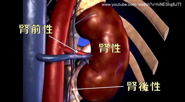 急性じん不全の3大要因～腎性・腎前性・腎後性の模式図