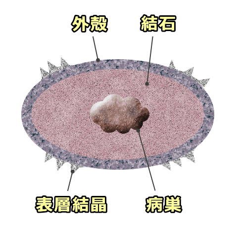 犬の尿石断面模式図～1つの尿石内に複数の層が含まれる