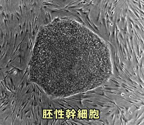 ES細胞（胚性幹細胞）の顕微鏡写真