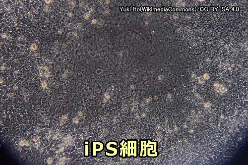 iPS細胞（人工多能性幹細胞）の顕微鏡写真