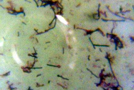 破傷風菌（Clostridium tetani）の顕微鏡写真