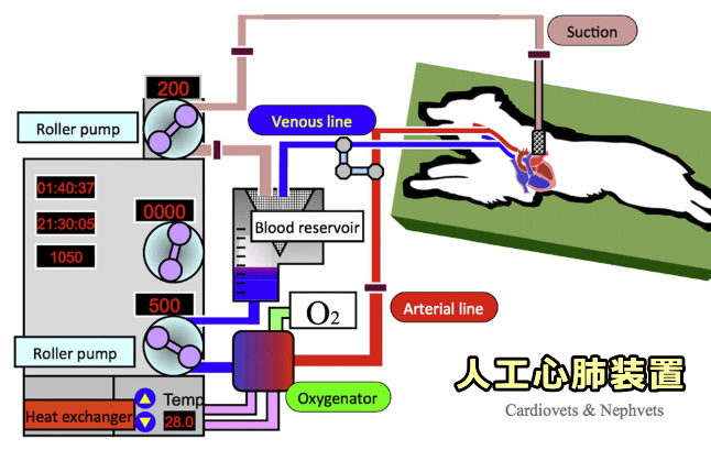 人工心肺装置の模式図