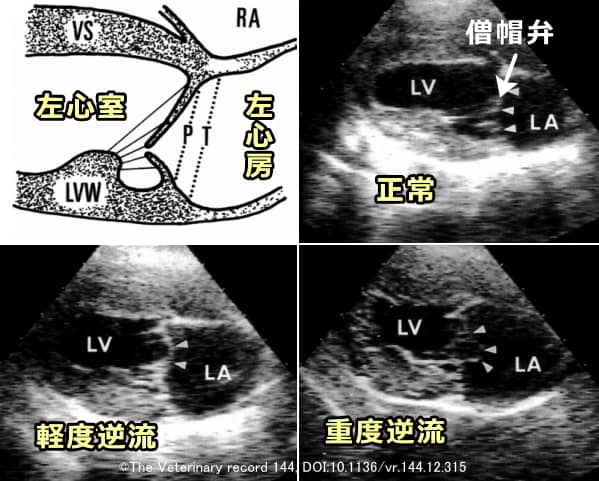 心エコー画像で見たときの僧帽弁突出と逆流の重症度