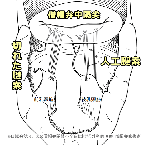 人工腱索を用いた犬の僧帽弁修復術