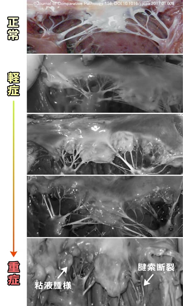 僧帽弁閉鎖不全症で多く見られる腱索及び弁尖の粘液腫様病変