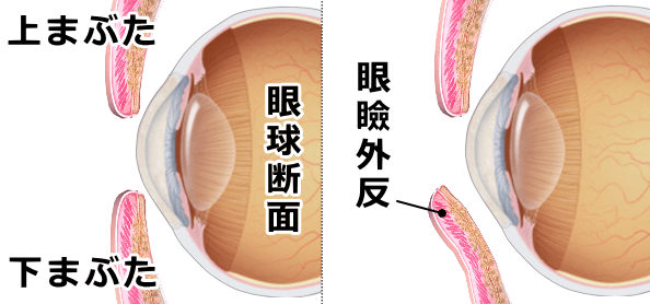 犬の眼瞼外反の模式図