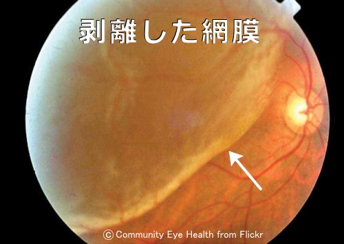 死者の網膜犯人像