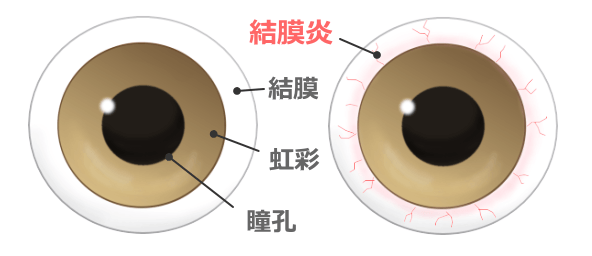 犬の眼球と結膜炎の模式図