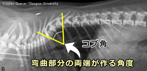 コブ角＝目的とするカーブの中で一番傾いている2つの椎体が形成する角度