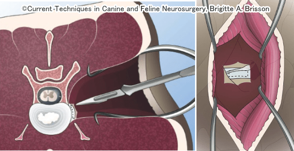 犬の椎間板に対して行われる開窓術の模式図