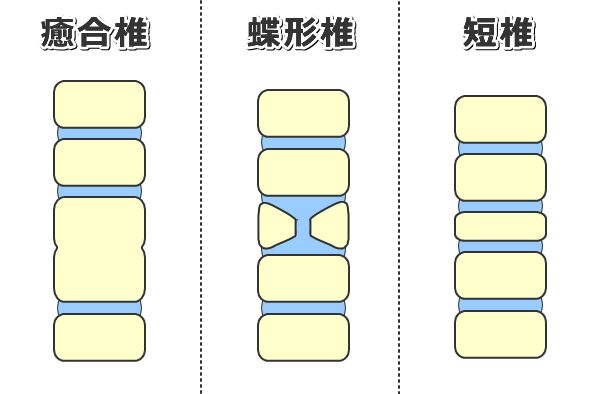 犬の脊椎奇形～癒合椎・蝶形椎・短椎