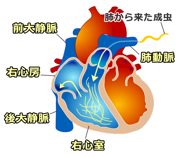 犬の大静脈症候群の模式図～血流に逆らってフィラリア成虫が後大静脈にまで侵入する