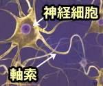 脳内にある神経細胞と軸索の模式図