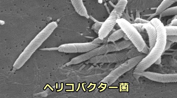ヘリコバクター菌の電子顕微鏡写真