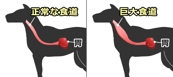 正常な食道と巨大食堂の比較模式図