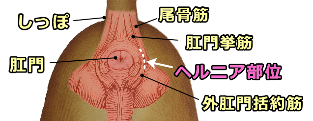 犬の会陰ヘルニア「尾骨筋」