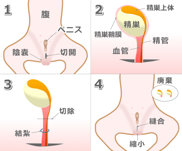 オス犬の去勢（精巣切除）・手術手順の図解