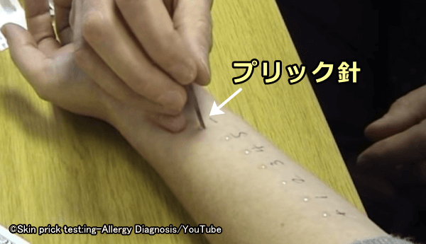 溶液の直下にプリック針で微小な傷をつける