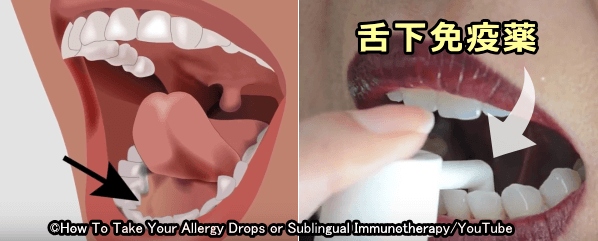 舌下免疫療法では低濃度のアレルゲンを粘膜経由で吸収させる