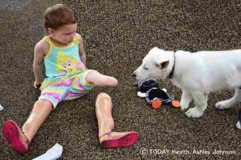 義肢を装着するサファイアちゃんと犬のダン大尉