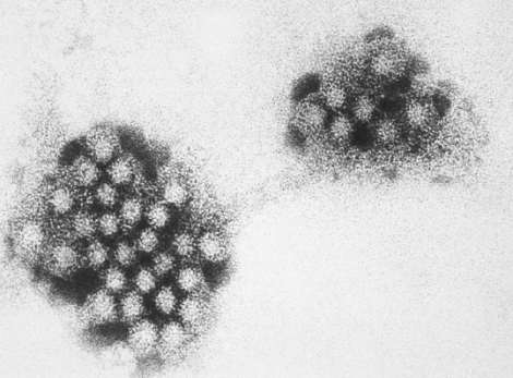 ノロウイルスの電子顕微鏡画像