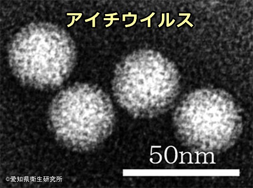 アイチウイルスの電子顕微鏡写真