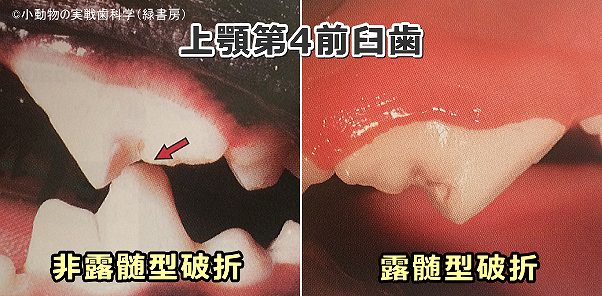 犬の上顎第4前臼歯に発生した破折（単純非露髄型と複雑露髄型）