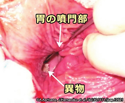 食道下部の異物に対して対して行われる胃切開術