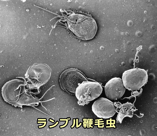 ジアルジア症を引き起こす原虫「ランブル鞭毛虫」 （giardia lamblia） 