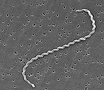 「レプトスピラ症」を引き起こすスピロヘータの顕微鏡写真