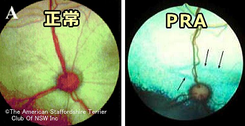正常な網膜と「進行性網膜萎縮症」（PRA）を発症した網膜の比較写真