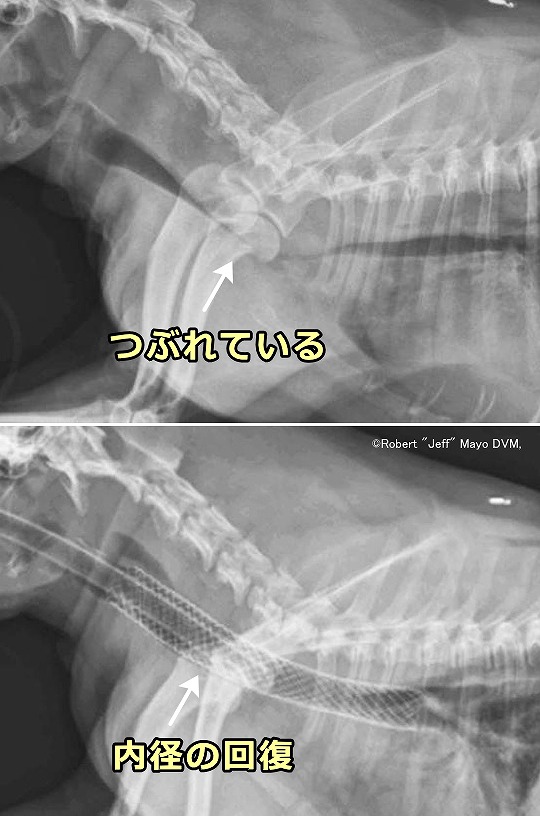 ステント挿入前後における気管のレントゲン写真