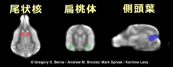 脳内における「関心関連領域」（ROI）～尾状核・扁桃体・側頭葉