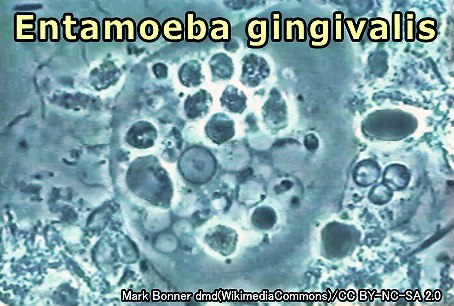 エントアメーバ・ジンジバリス（Entamoeba gingivalis）の顕微鏡写真