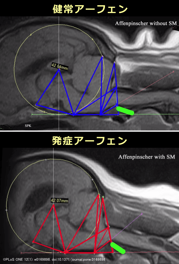 脊髄空洞症を発症したアーフェンピンシャーと健常なアーフェンピンシャーにおける脳のMRI比較画像