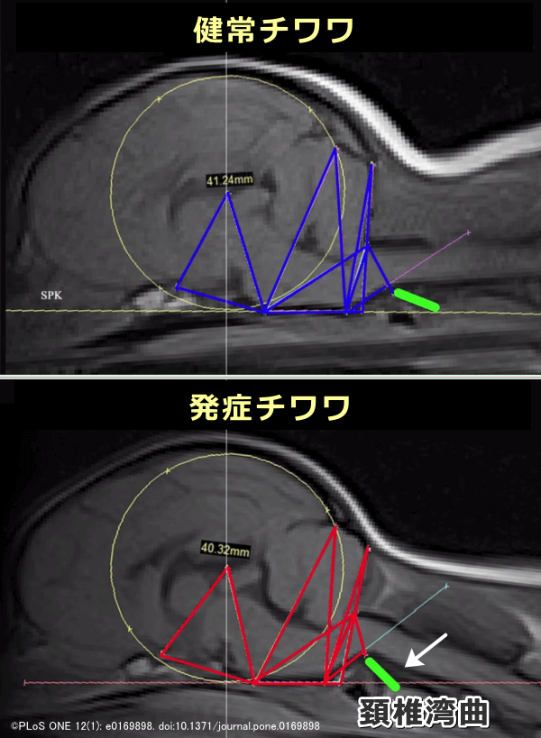 脊髄空洞症を発症したチワワと健常なチワワにおける脳のMRI比較画像