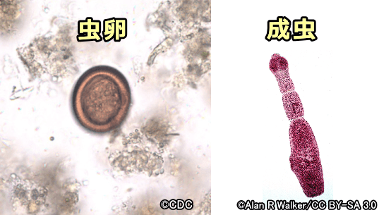 エキノコックスの虫卵と成虫