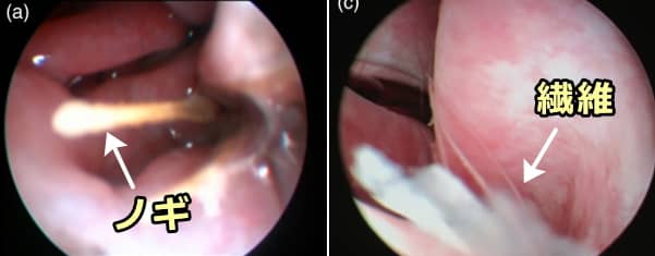 犬の鼻腔内異物～ノギと繊維