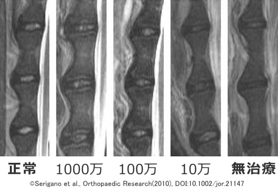 犬の椎間板に間葉系幹細胞（MSC）を注入してから12週後のMRI画像