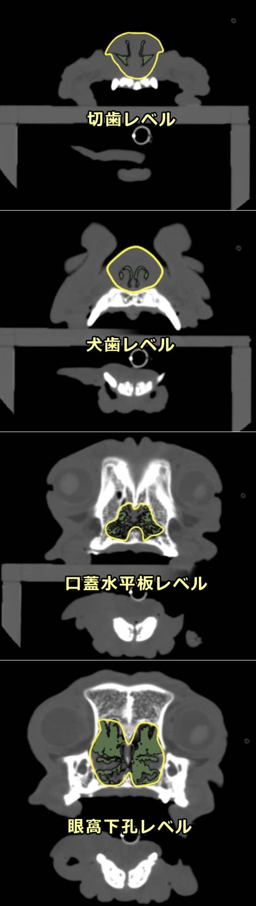 総鼻腔領域を気道横断領域で割ったAA/NC比の模式図