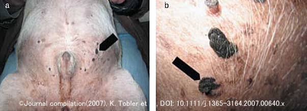 パグの腹部に発症したウイルス性色素プラーク