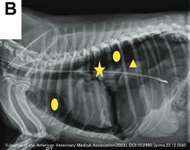誤挿入した経鼻胃管の位置を調整した直後における胸部エックス線画像