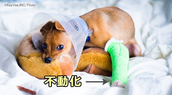 怪我の後のギブス固定では関節の不動化を余儀なくされる
