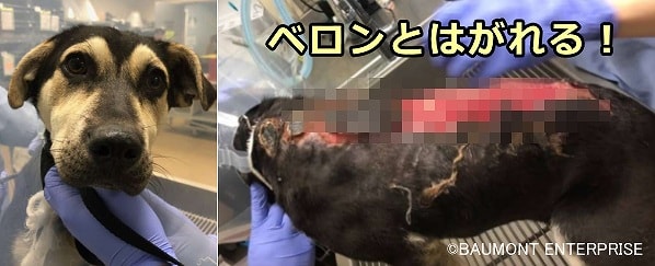 長時間の日照で皮膚に火傷が生じる「日光皮膚炎」(sunburn)