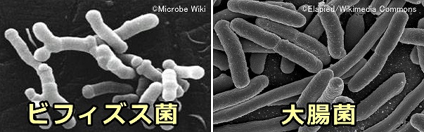 善玉菌の代表「ビフィズス菌」と悪玉菌の代表「大腸菌」