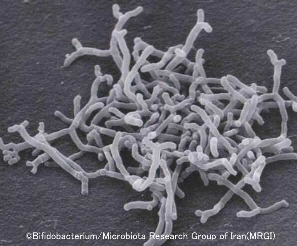 ドッグフードの成分として用いられる「ビフィズス菌」の電子顕微鏡拡大写真